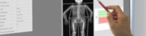 Diagnostic Testing Bones