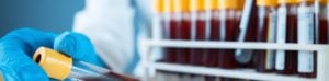 Lab Services Blood Work