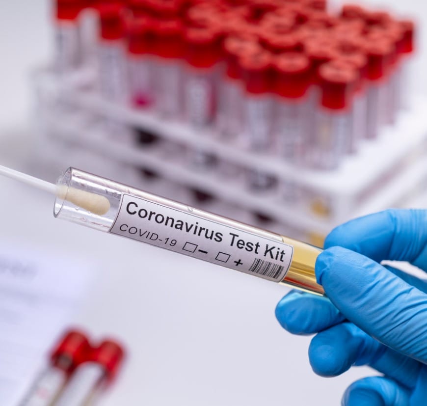 Coronavirus Covid 19 Test Kit Novel Corona Virus