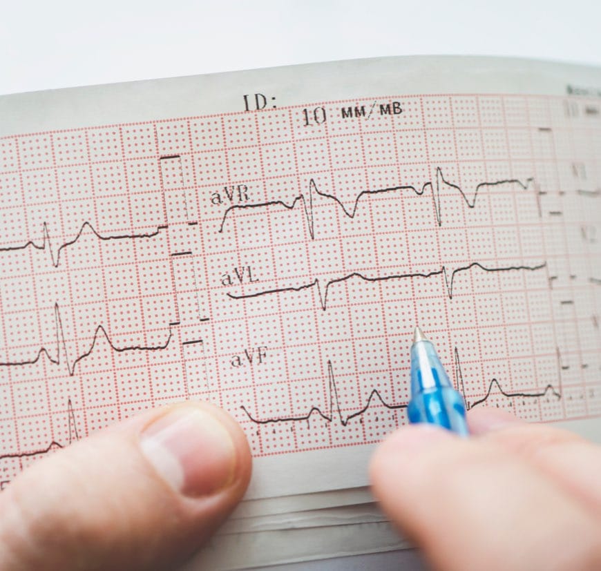 Electrocardiogram in hands of doctor Electrocardiogram in hands of doctor